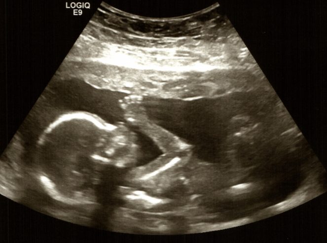 Ava Melendez Countdown